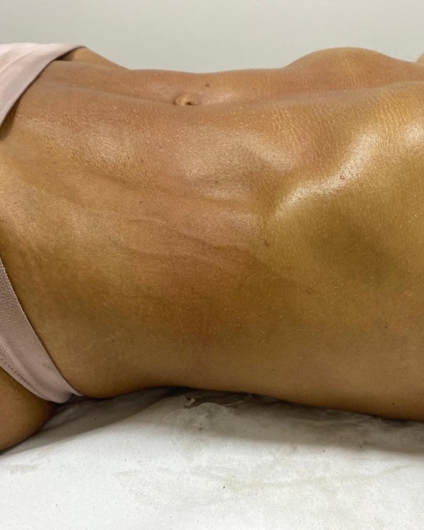 Massagem Modeladora - Resultado 3